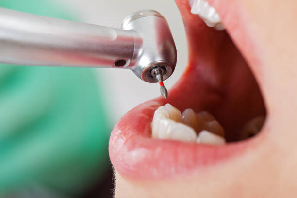 Best Emergency Treatment for Dental Infections or Abscesses in Sixteen Mile Stand, OH